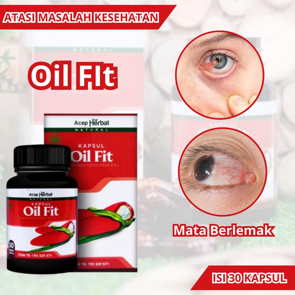 Obat Mata Berlemak Pterigium, Obat Selaput Mata Berlemak, Obat Mata Buram, Obat Mata Rabun, Obat Gum