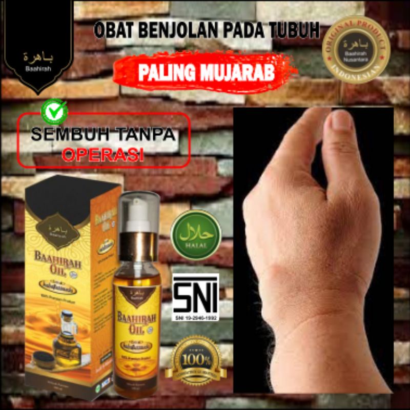 (TERLARIS) BAAHIRAH OIL MENGHILANGKAN SEGALA JENIS BENJOLAN KISTA, LIPOMA, KANKER, DLL