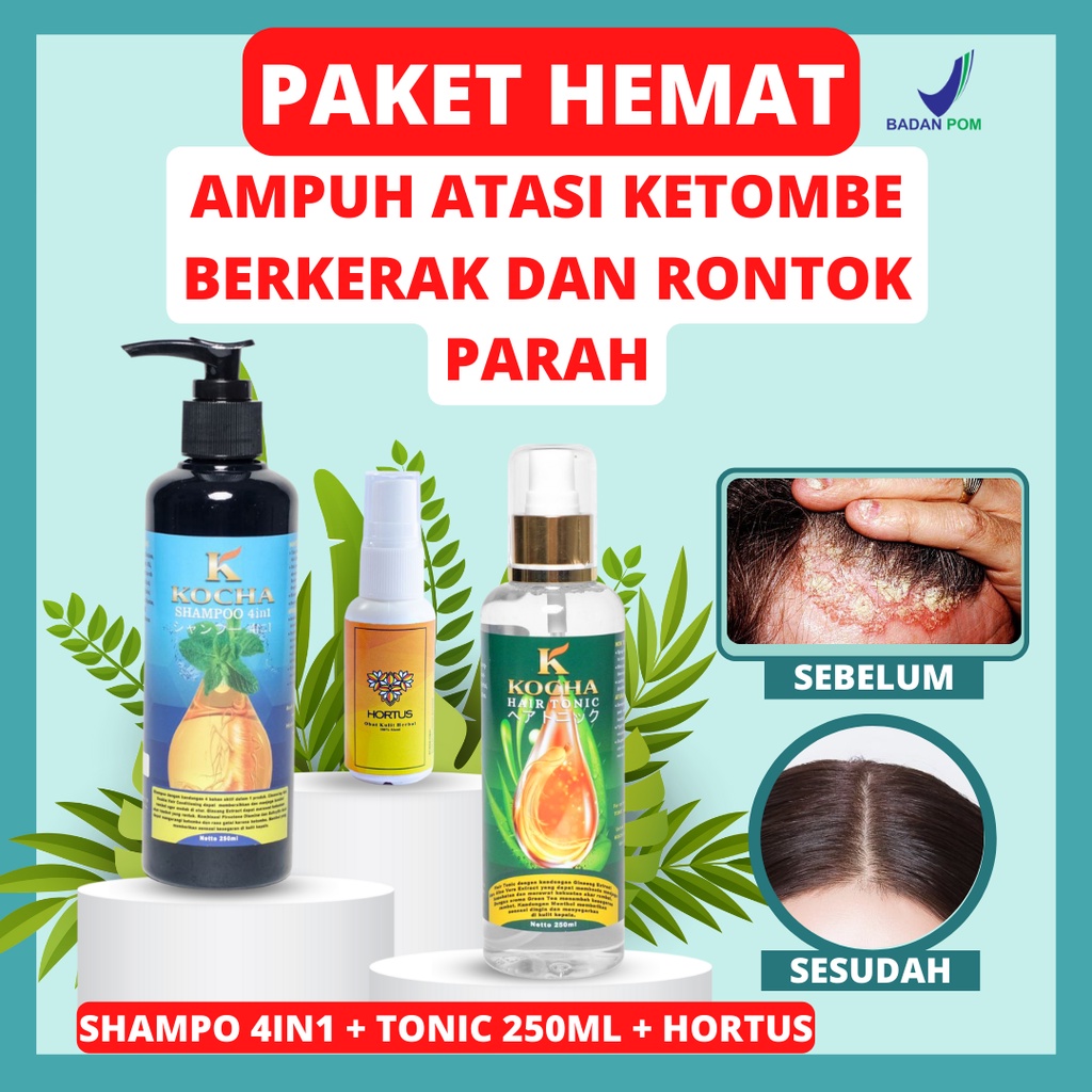 Paket Psoriasis paling ampuh Shampo ketombe membandel dan berkerak Shampoo Rambut Rontok kocha