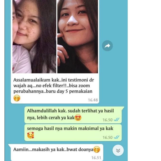 ADERA SERUM ORIGINAL FACE SERUM ADERA WAJAH ORI UNTUK FLEK HITAM GLOWING ORIGINAL ASLI 100%