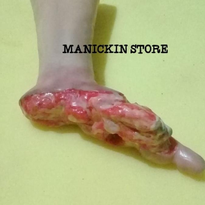 Kaki Luka Diabetes | Alat Peraga | Phantom Manekin