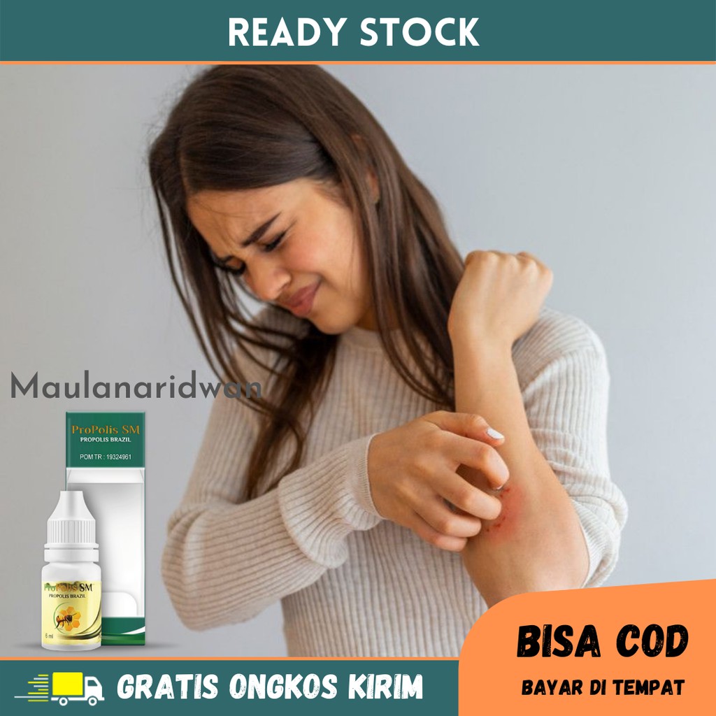 Obat Eksim Menahun, Gatal Eksim, Eksim Basah / Kering, Obat Herbal Infeksi Kulit - Propolis SM
