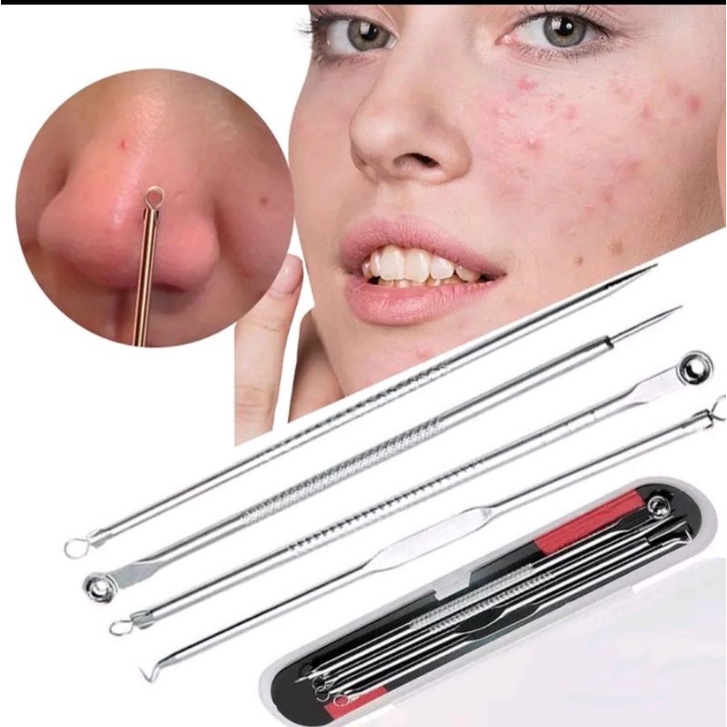 PINSET KOMEDO 4 IN 1 ALAT PENCET JERAWAT PEMBERSIH BLACKHEAD