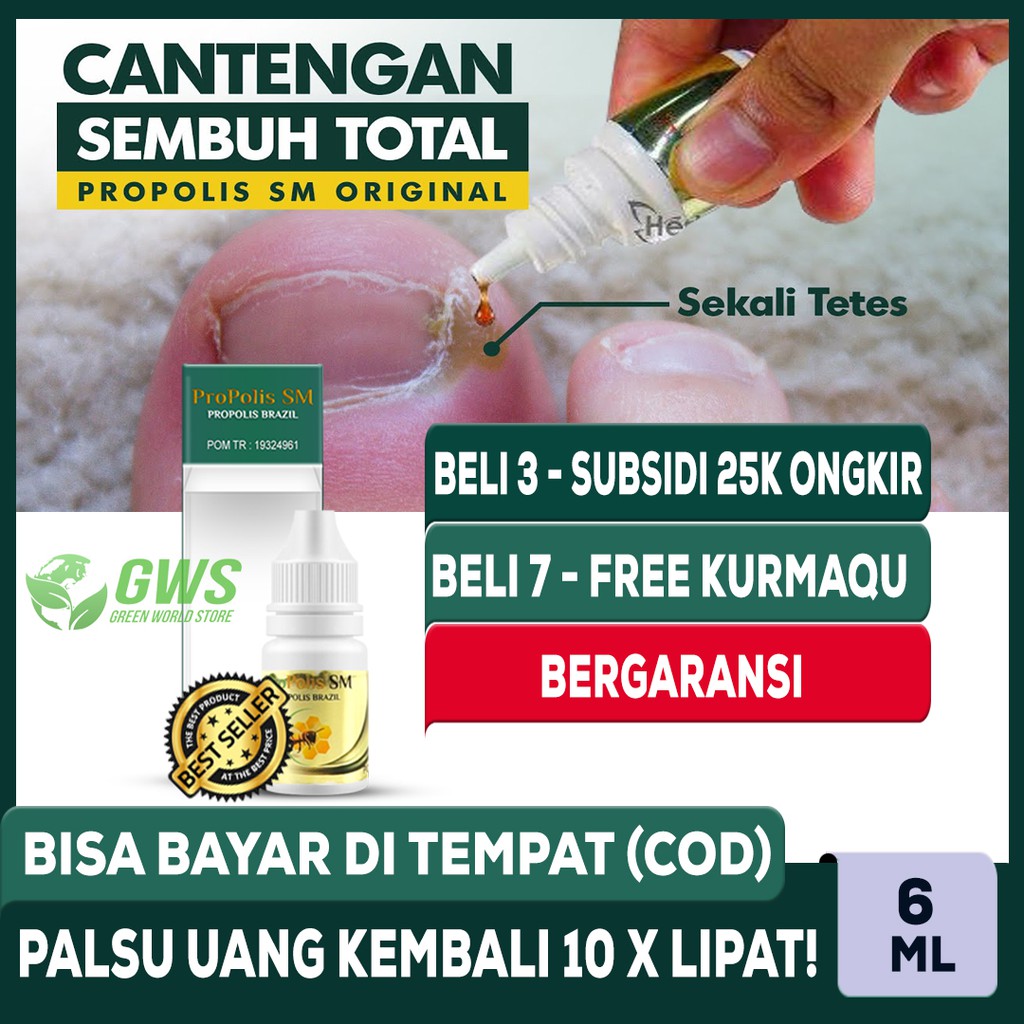 Obat Cantengan Di Jempol Kaki Kuku Bernanah Berbau Propolis Paling Laris Tangerang Banten Shopee Indonesia