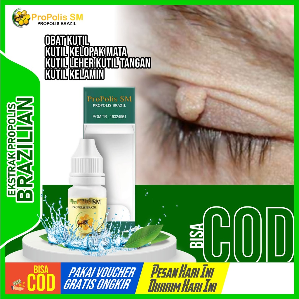 Obat Kutil Kutil Kelopak Mata Kutil Leher Kutil Tangan Kutil Kelamin - Penghilang Perontok Kutil Pro