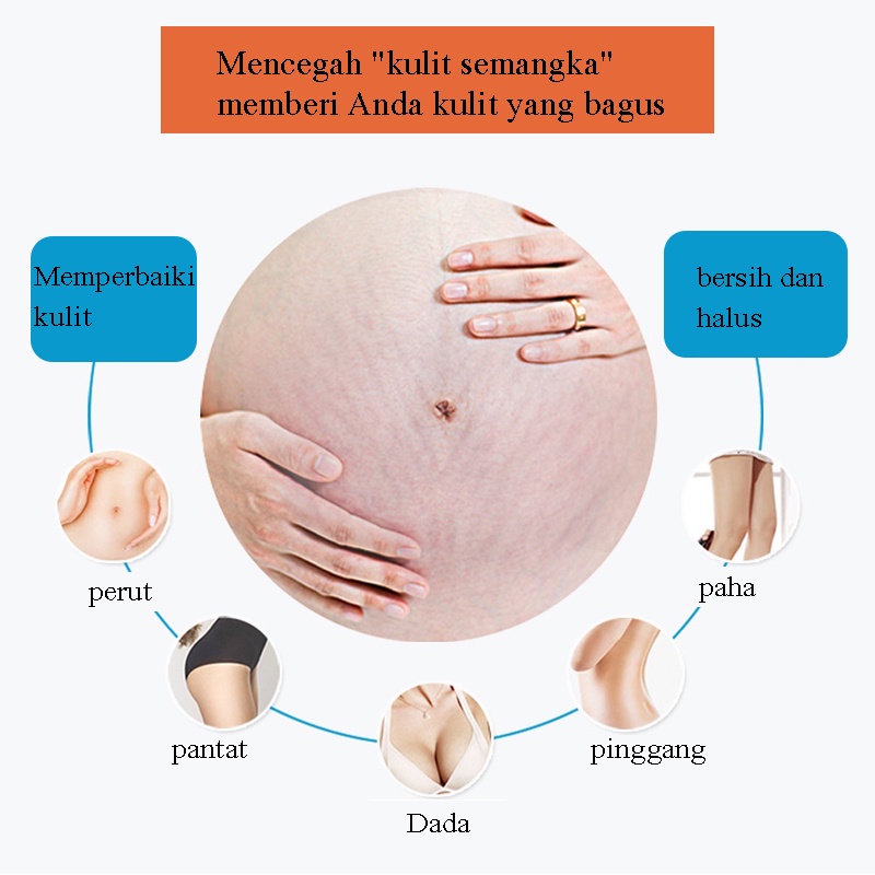 Stretch Mark Cream 45g / Penghilang Stretch Mark / Stretch Marks Pilihan Ibu / BPOM Penghilang Stretch Mark Ampuh / Mengencangkan kulit, mengembalikan kehalusan dan elastisitas