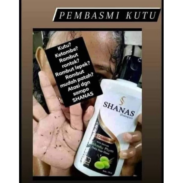 SHANAS SAMPO NASA ( Anti Kutu)