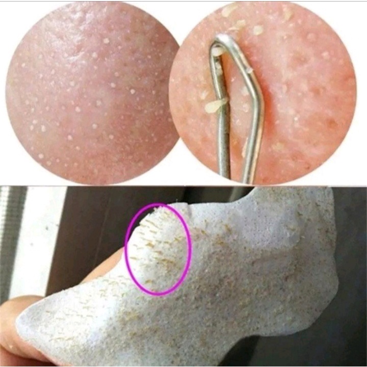 Strip Pembersih Komedo/Pori-Pori Hidung