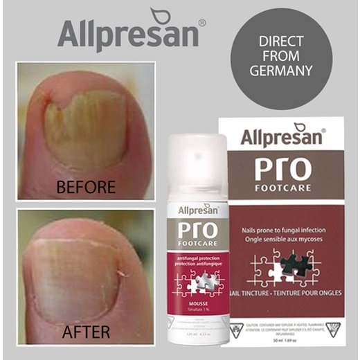 Allpresan Nail Tincture Anti Fungal Protection 50ml