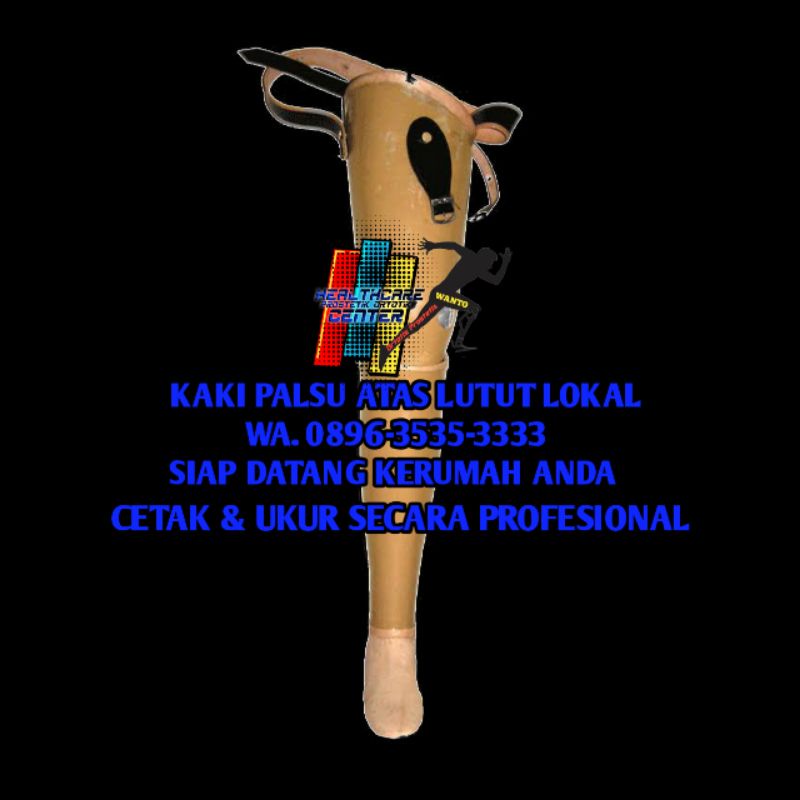 Kaki Palsu Atas Lutut Lokal Murah