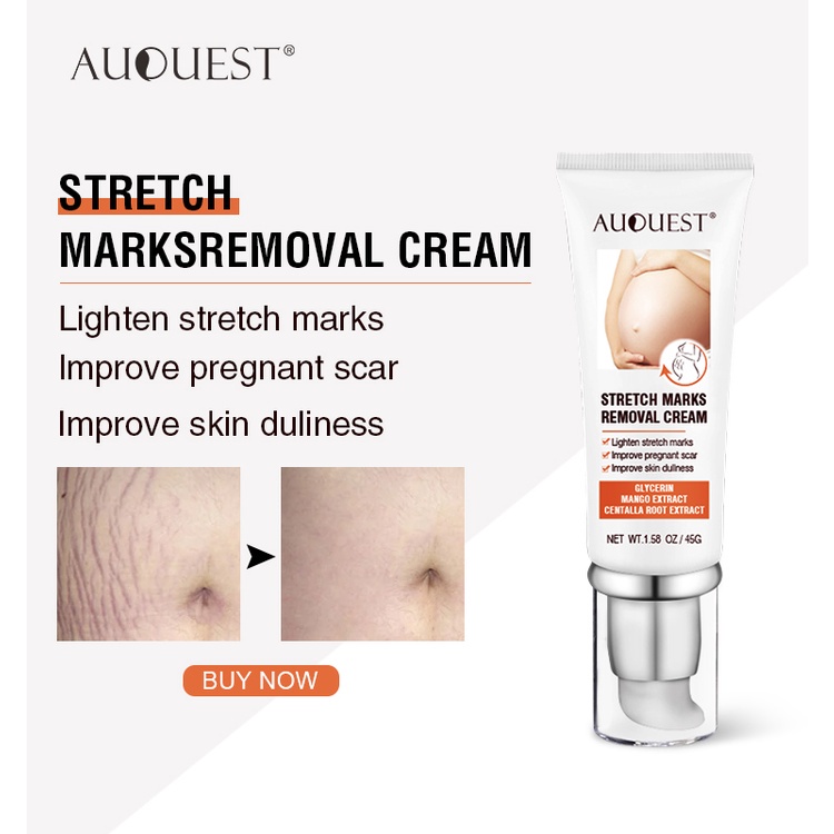 Penghilang strechmark  Strechmark cream Secara efektif menghilangkan stretch mark  Aman dan efektif