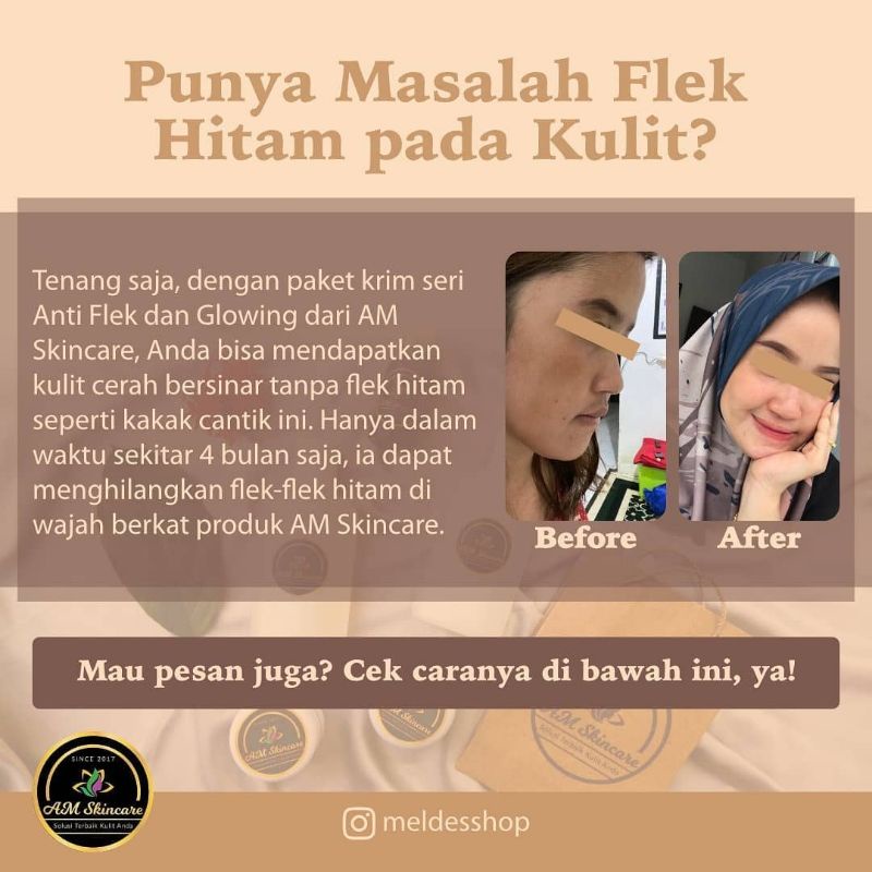 CREAM MALAM FLEK PLUS GLOWING BY AMSKINCARE | CREAM PENGHILANG FLEK HITAM