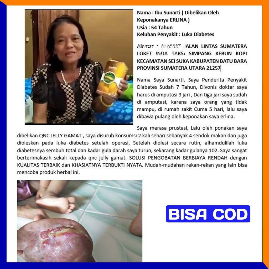 Obat Khusus Luka Diabetes Telapak Kaki Bolong Berlubang Bernanah Qnc Jelly Gamat Shopee Indonesia