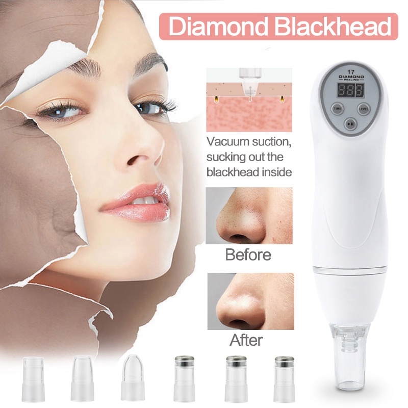 2 in 1 Diamond Peeling Alat Dermabrasi dan Penyedot Komedo - Alat Microdermabrasi Profesional untuk Perawatan Kulit Mulus dan Bersih