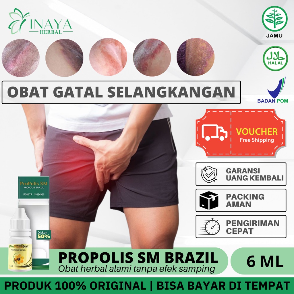 Jual Privasi Obat Gatal Selangkangan Obat Kurap Di Selangkangan