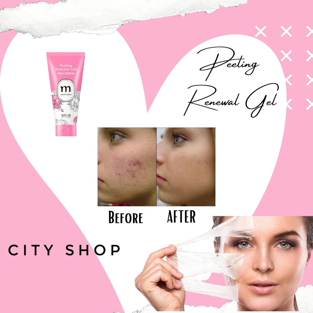 CITY SHOP Peeling Renewal Gel - Peeling Wajah - Exfoliating - Peeling Komedo  Triple Action