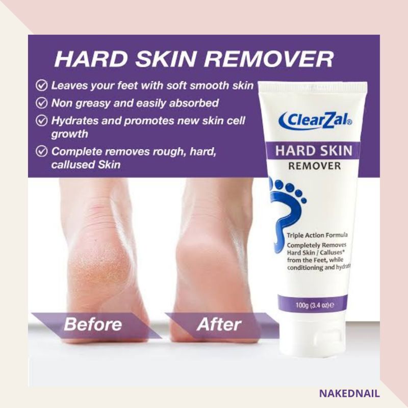 Clearzal hard skin remover , remove dead /dry skin soften feet USA ori