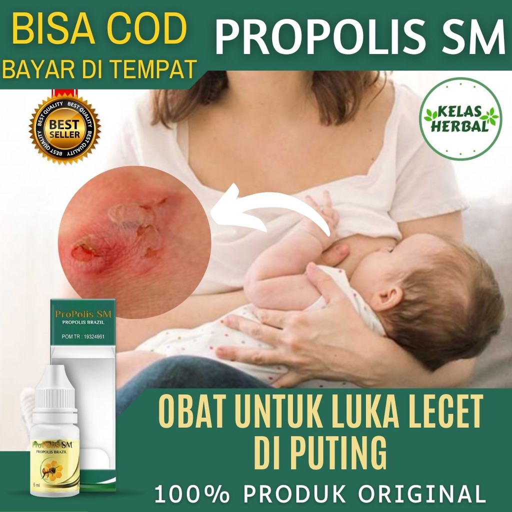 Obat Luka Puting Lecet, Salep Puting Lecet Mengelupas, Perih, Nyeri, Puting Gatal, Puting Bernanah, 