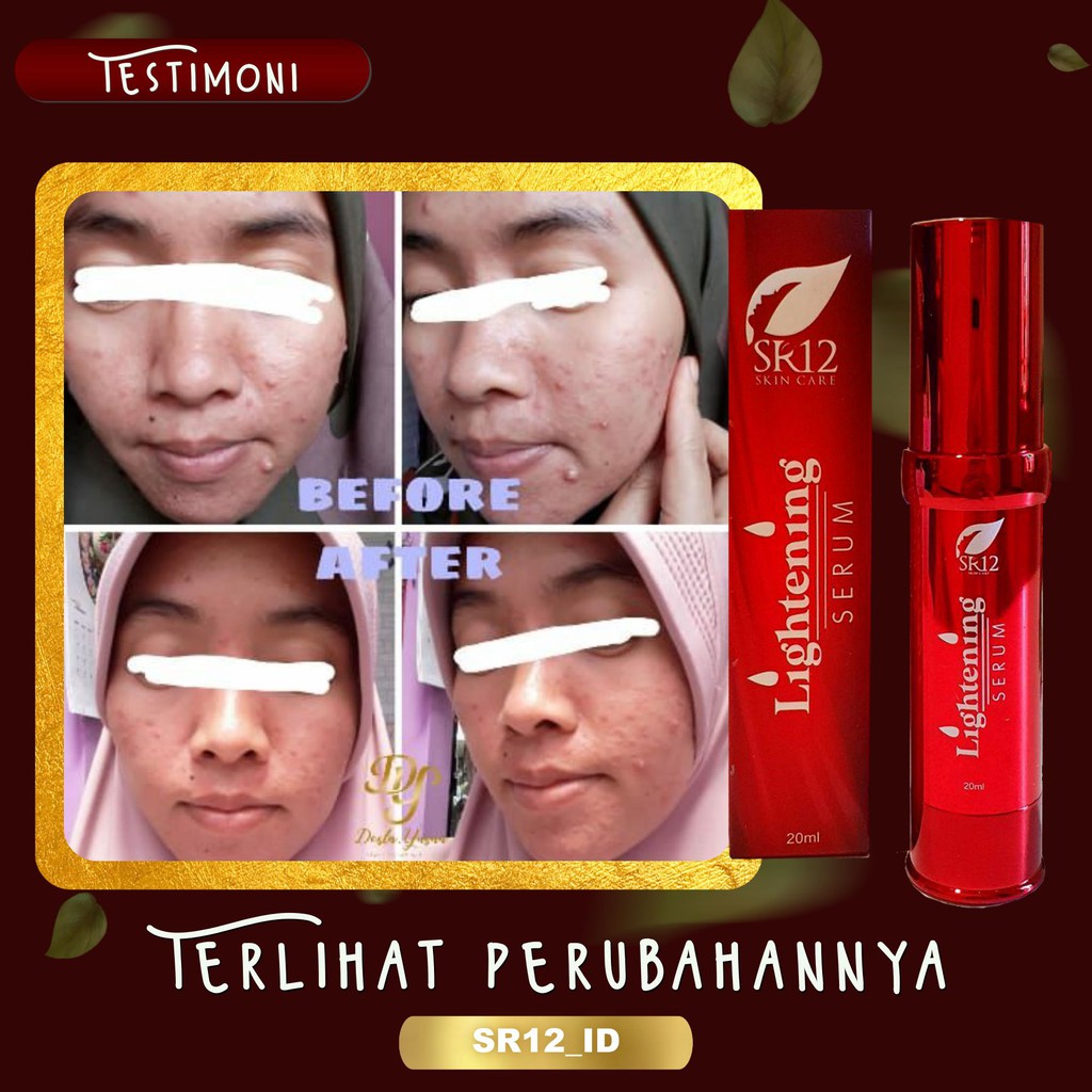 LIGHTENING SERUM SR12 / SERUM PENCERAH WAJAH AMPUH