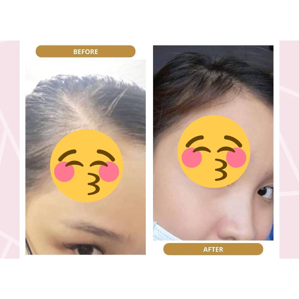 BIO HERBAL GINSENG PAKET SHAMPOO - HAIR TONIC - PENUMBUH RAMBUT BOTAK - TONIC RAMBUT PENUMBUH RAMBUT