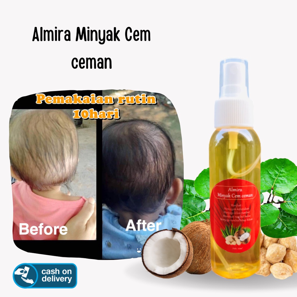 Hair Vitamin Hair Growth Spray Minyak Kemiri Penumbuh Rambut Rontok