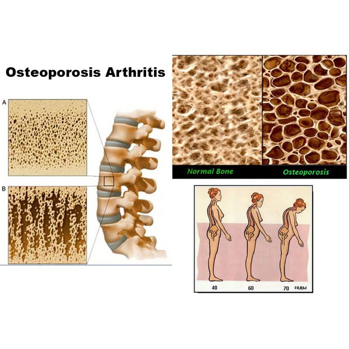 KALSIUM MAGNESIUM BONE with Vitamin D3 USA IMPOR