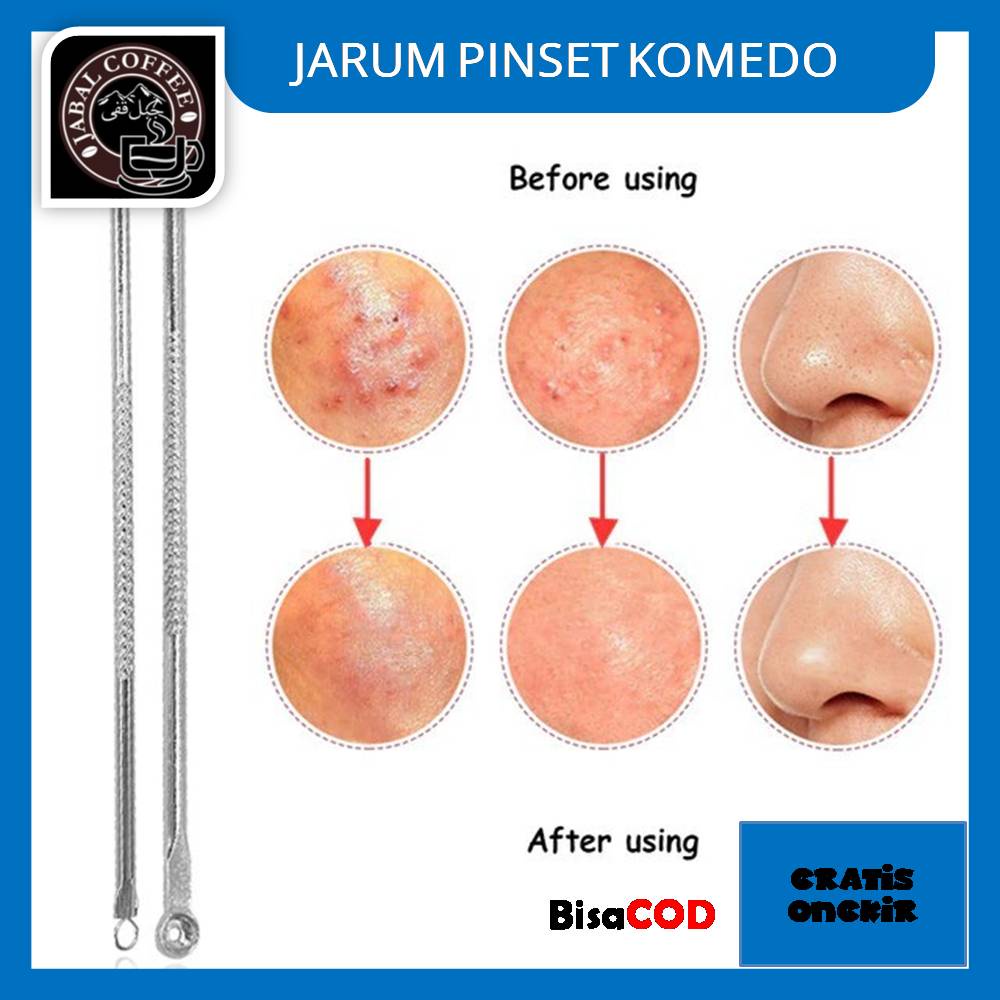 Pinset Komedo / Pencetan Jerawat / Alat Pencetan Jerawat Stainless / Pencetan KomedoJ162