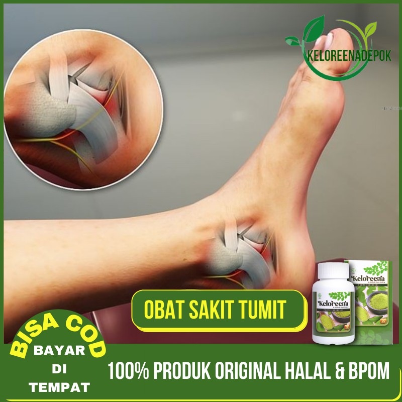 Obat Sakit Tumit Herbal Mengatasi Telapak Kaki Sakit Saat Berjalan Plantar Fasciitis Keloreena Shopee Indonesia