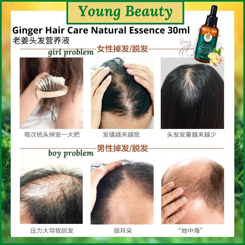 【Barang Spot】Esensi Pertumbuhan Rambut Minyak Penumbuh Rambut Esensi Perawatan Rambut Jahe Anti Rambut Rontok Menyehatkan Kulit Kepala Perawatan Rambut Esensi Pertumbuhan Rambut Jahe Ginger Hair Growth Essence Hair Care