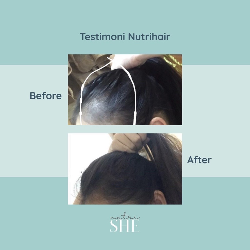 NUTRISHE NUTRIHAIR TREATMENT OIL-3