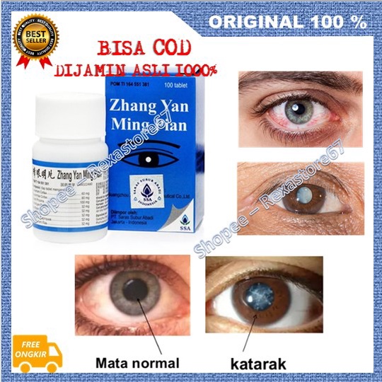 [BISA COD] Zhang Yan Ming Pian Obat Herbal Cina Mengobati Mata Katarak Dan Rabun ORIGINAL BPOM