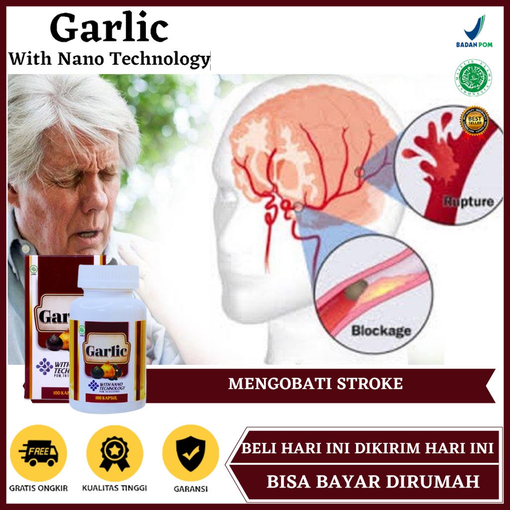 Obat Sakit Stroke, Obat Stroke Ringan, Obat Stroke Iskemik, Obat Stroke Sebelah Kiri, Obat Stroke Se