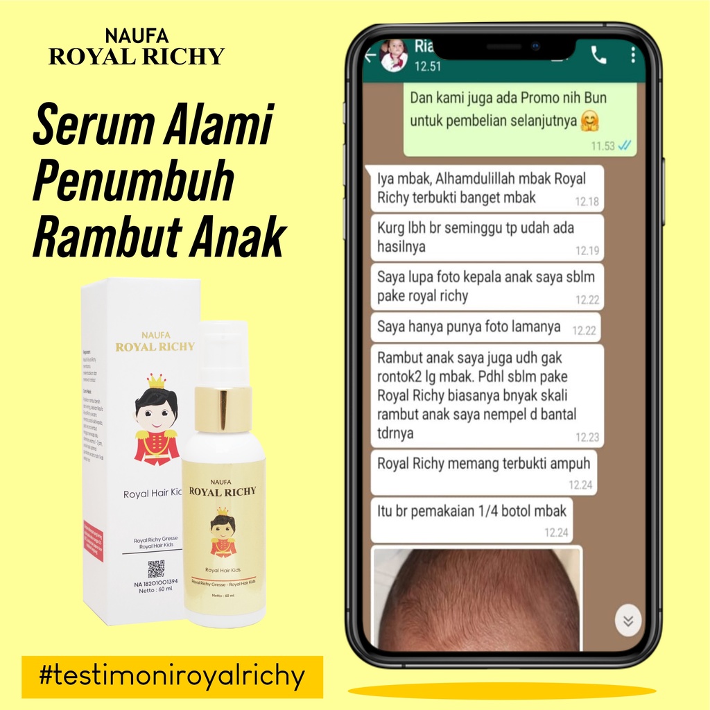 Naufa Royal Richy -  Serum Multivitamin Minyak Kemiri Penumbuh Penyubur &amp; Penebal Rambut Anak Bayi &amp; Dewasa