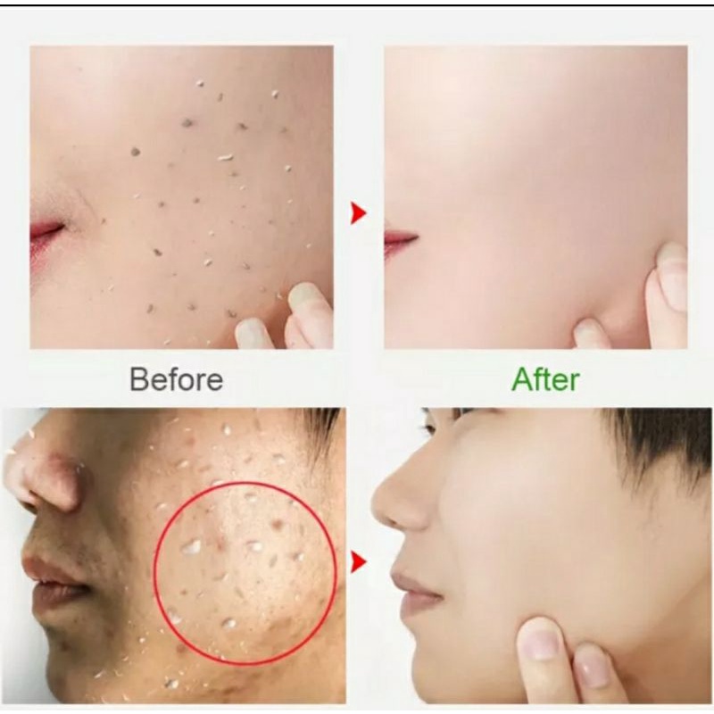 GIRLPAL CENTELLA ASIATICA PEELING GEL | FACIAL EXFOLIATING | MENCERAHKAN WAJAH