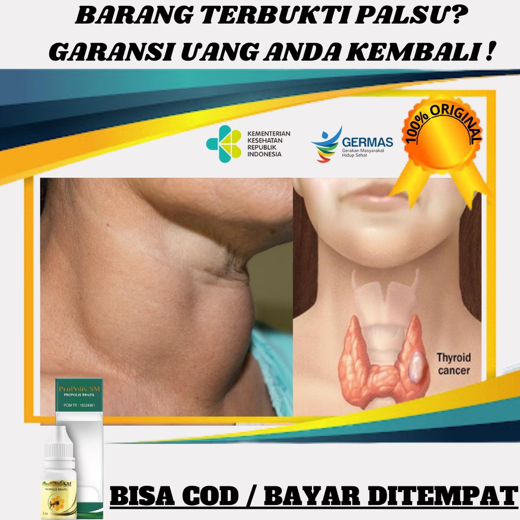 Obat Tiroid / Penyakit Tiroid / Tiroiditis / Pembengkakan Kelenjar Tiroid / Tiroid Bengkak / Benjola