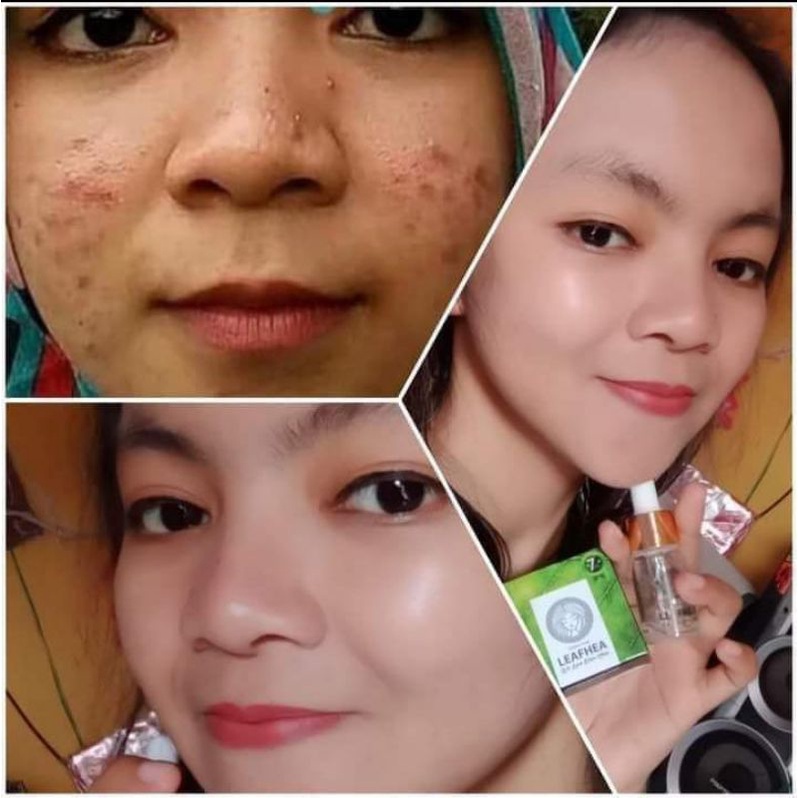 Sabun leafhea ORI 100,%