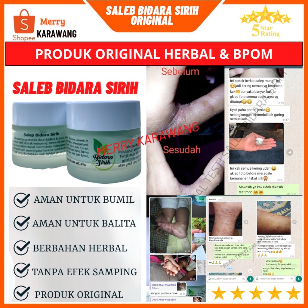 Salep Bidara sirih original Salep Gatal