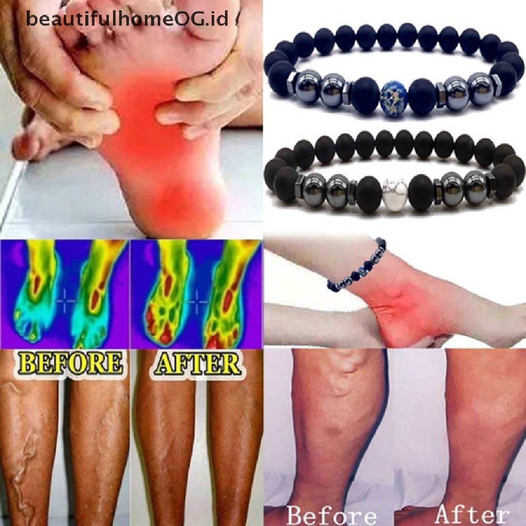 Perhiasan Gelang Kaki Batu Hematite Magnetik Untuk Unisex