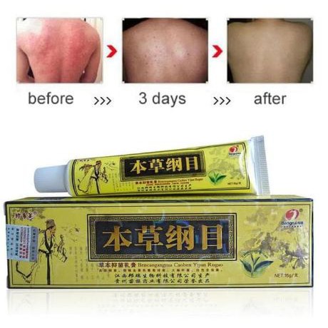 Obat Gatal Salep Eksim Psoriasis Efektif Untuk Kesehatan Kulit Gatal Ampuh SALEP KUNING-4