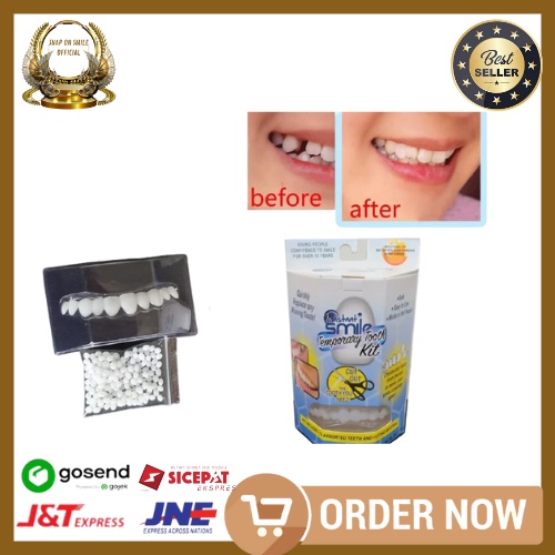 Gigi Palsu Instan Tempel Temporary Tooth Kit
