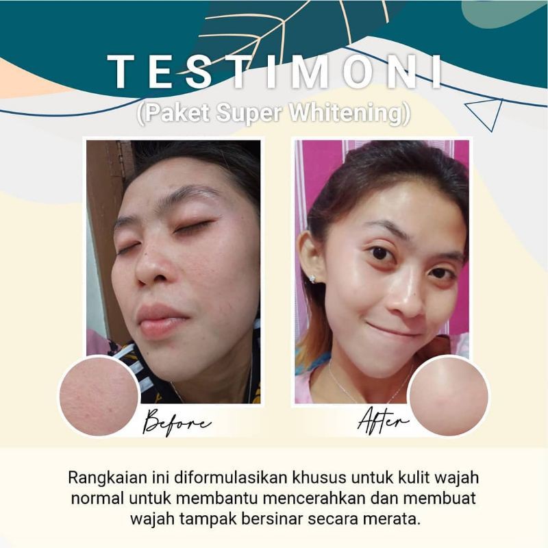 Jglow Skincare Paket Super Whitening Glowing Paket Perawatan Wajah Kecantikan Bpom-3