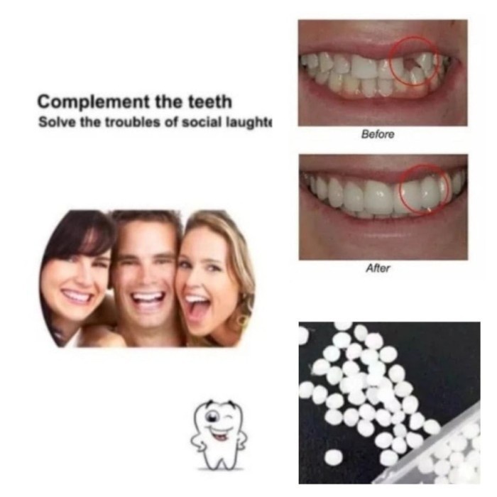 Fident Penambal Gigi