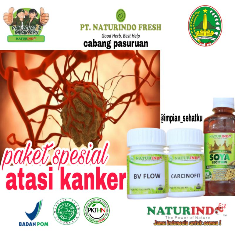 

paket herbal naturindo khusus untuk menghancurkan jaringan sel kanker, seperty kanker payudara, kanker rahim, kanker otak, tumor ganas / jinak, leukimia