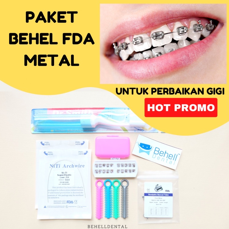 Behelldental - PAKET BEHEL PERMANEN PERBAIKIN GIGI TIPE BRACKET FDA MIM ROTH HIGH QUALITY - Kawat Dental Geousis Luxury With Hook 0.22 Perawatan Gigi Mini Metal