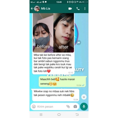 Sabun Kedas Beauty Di jamin original 100% ( Cek member resmi)