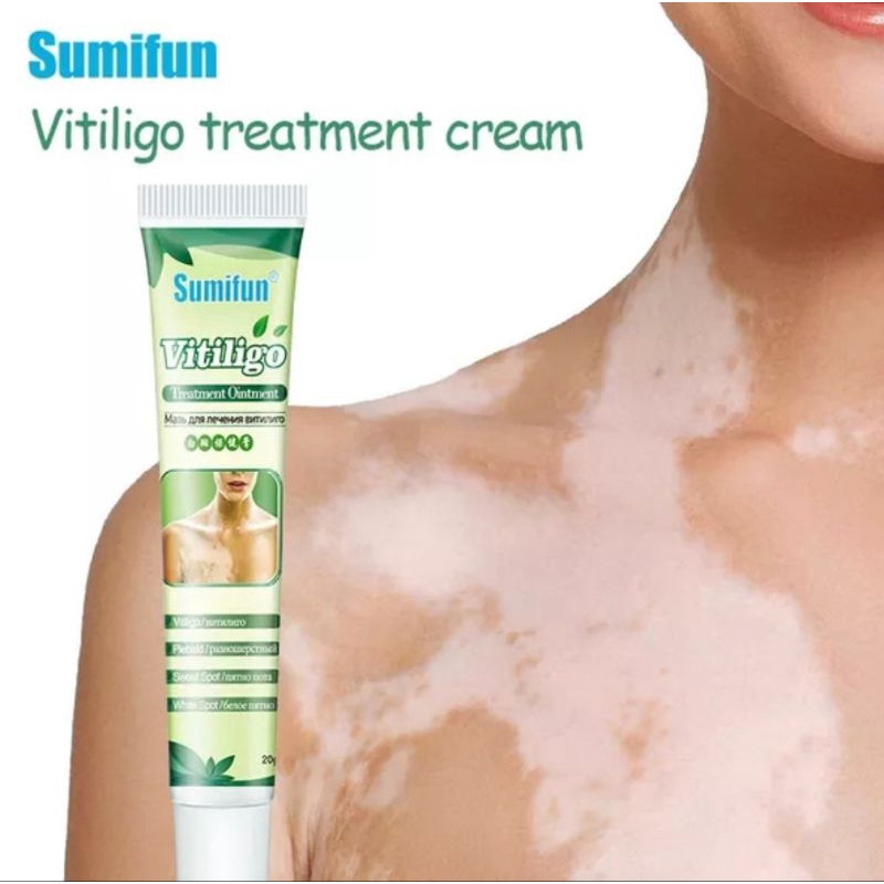 SUMIFUN VITILIGO OBAT PENGHILANG BERCAK PUTIH HERBAL AMPUH MENGHILANGKAN PIGMENT PUTIH  MERATAKAN WARNA KULIT-20gr