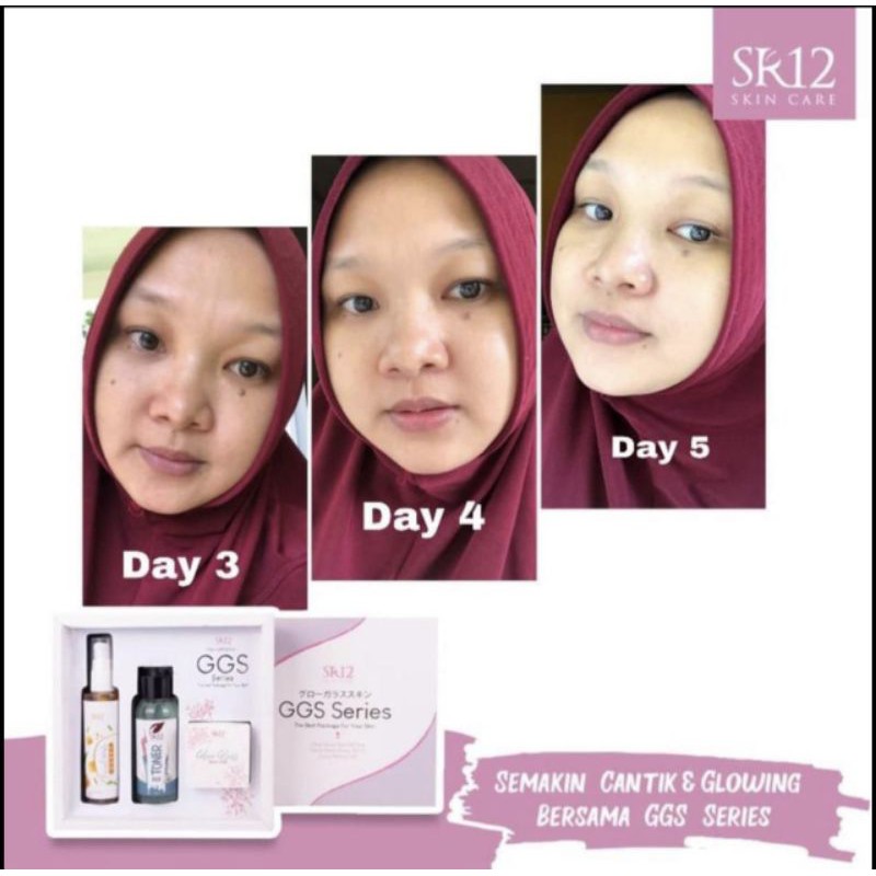 GLOW GLASS SKIN SERIES SR12 / SKINCARE PAKET GLOWING DALAM 7 HARI / KRIM PEMUTIH WAJAH / KRIM PENCERAH WAJAH / saudagarsr12