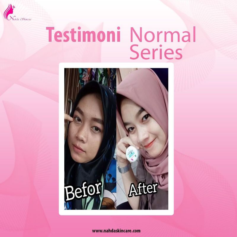 Nahda Skincare | Nahda Skincare 100% Original | Nahda Skincare BPOM | Nahda Skincare Paket Glow Acne & Glow Normal-6
