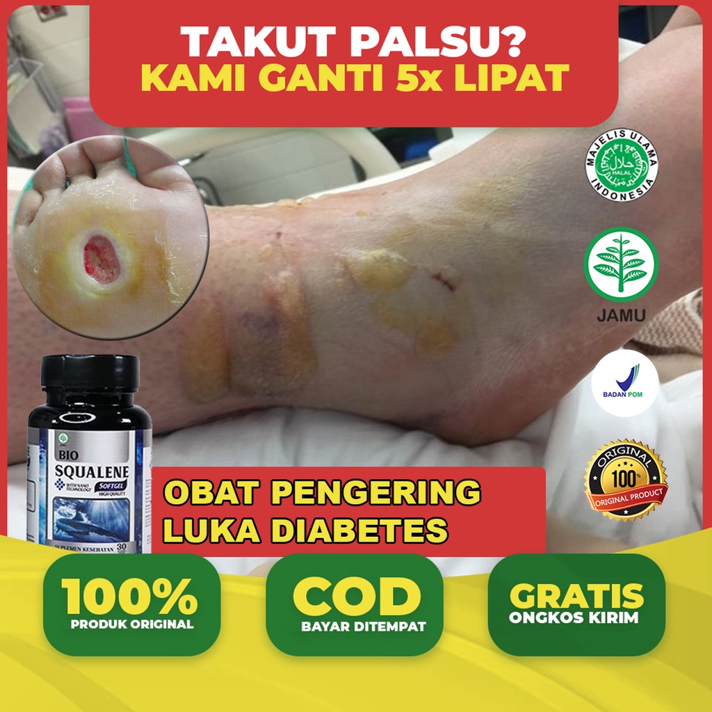 Obat Pengering Luka Diabetes - Pengering Luka Jatuh - Obat Luka Diabetes Membusuk & Berbau - Obat Di