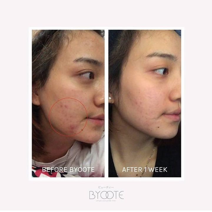 BYOOTE Collagen Glutathione - Suplemen Kecantikan Perawatan Kulit Tubuh